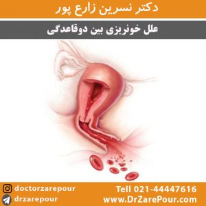 علل خونریزی بین دو قاعدگی