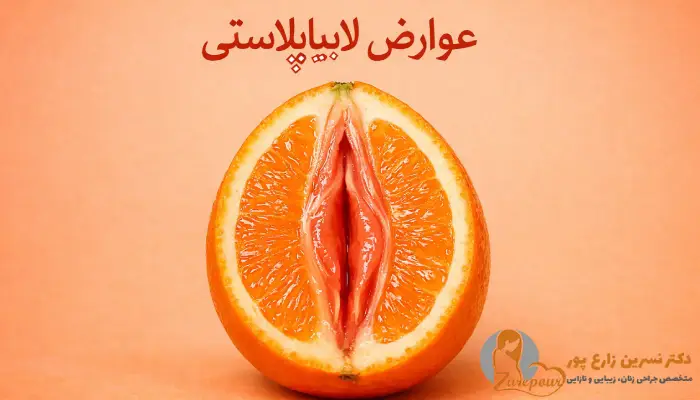 عوارض لابیاپلاستی
