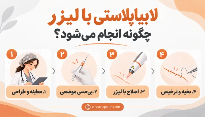 اینفوگرافیک مراحل لابیاپلاستی با لیزر شامل معاینه و طراحی، بیحسی موضعی، اصلاح با لیزر، بخیه و ترخیص