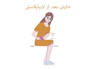 خارش پس از لابیاپلاستی