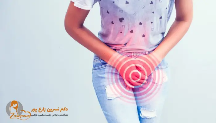 عفونت بعد از لابیاپلاستی