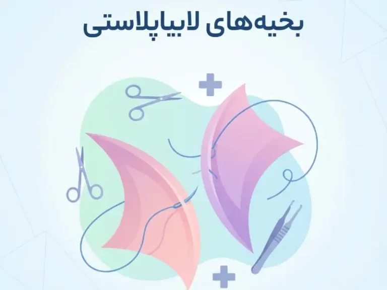 بخیه های لابیاپلاستی