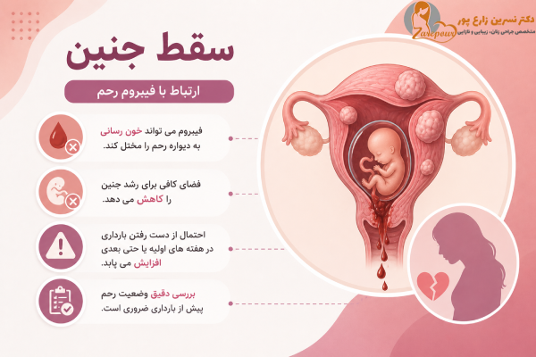 سقط جنین