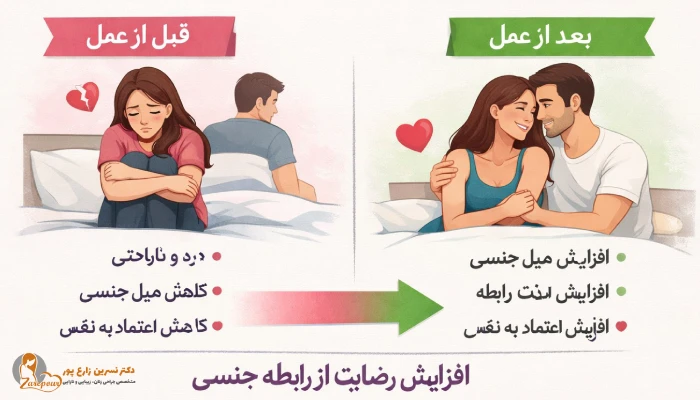 تاثیر لابیاپلاستی بر میل جنسی