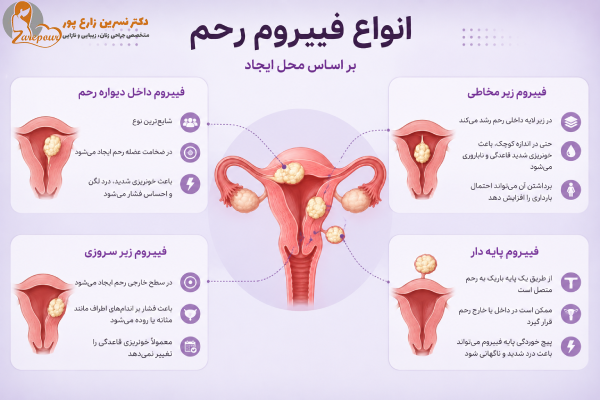 انواع فیبروم رحم